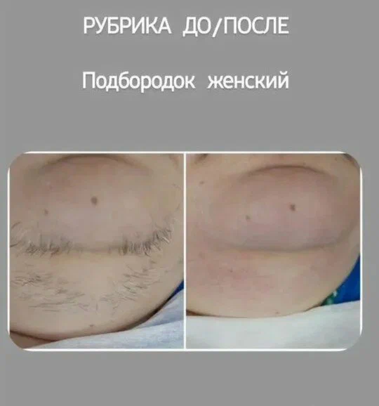 Пример результата процедуры